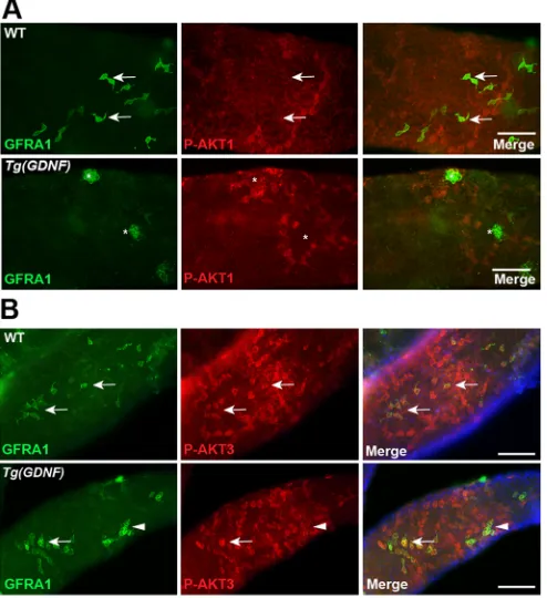 Fig. 6. AKT1 and AKT3 are phosphorylated in different types ofspermatogonia. (A) Whole-mount wild-type or Tg(Gdnf) tubules co-immunostained for phosphorylated AKT1 Ser473 (P-AKT1) and GFRA1.GFRA+ cells in wild-type testes (arrows) and large clusters of GFR