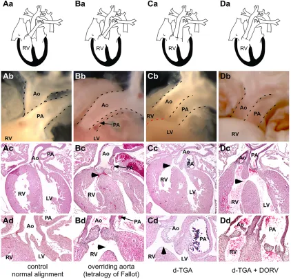 Fig. 1. Mef2c function in the AHF is required for proper OFT alignment. (Aa-d) Normal alignment of the aorta (Ao) and pulmonary artery (PA) in controlneonatal mice