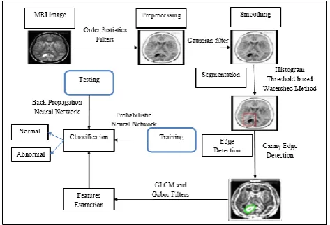 Figure 1.Brain Tumor Detection Based on PNN Training Process with BPNN Classification 