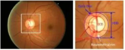 Fig. 1. Major structures of the optic disc. 