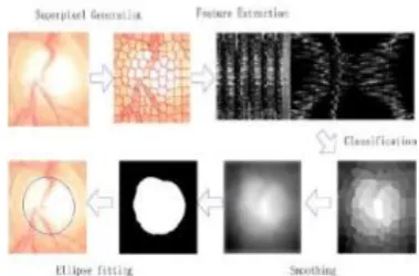 Fig 5:Superpixel based optic cup segmentation