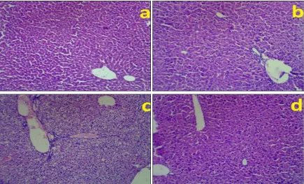 FIG. 8: ACUTE HISTOPATHOLOGICAL FINDINGS OF LIVER IN MICE AFTER ORAL ADMINISTRATION OF Se DOPED ZnO NANOPARTICLES (Zn0.80Se0.20O1-δ); (a) WITH CONTROL I.E., WITH NO DOSAGE OF NANOPARTICLES (SHOWS NORMAL MORPHOLOGY OF HEPATOCYTES); (b) TREATED WITH 500 mg/kg BODY WEIGHT (B.W.) (SHOWS ALTERED HEPATOCYTES ARCHITECTURE); (c) TREATED WITH 1000 mg/kg BODY WEIGHT (B.W.) (SHOWS MICROVESICULAR STEATOSIS); (d) WITH 2000 mg/kg BODY WEIGHT (B.W.) (SHOWS CENTRAL VEIN CONGESTION)  