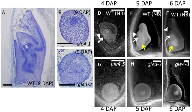 Fig. 1. Morphology of gle4 embryos. (A-C) Longitudinalsections of embryos at 9 days after pollination (DAP) inwild type (WT) (A), gle4-1 (B) and gle4-3 (C)