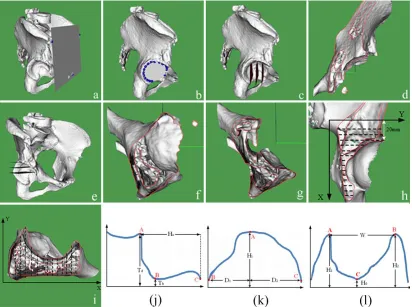 Figure 1 (a) The APP of the pelvis model. (b) The fitted circle of the acetabular wall