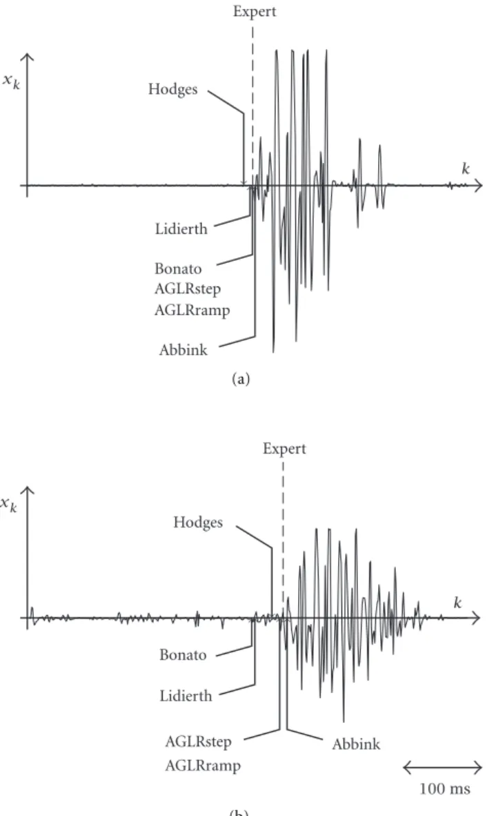 Figure 8: Raw SEMG signals obtained in a reaction time experiment: two sample traces (a) and (b) with different SNR