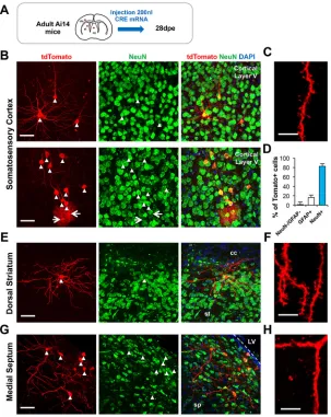 Fig. 5. Mature neurons in the parenchyma of adult mice canbe electroporated by mRNAs. (A) Adult Ai14 mice wereinjected with CRE mRNAs in three different brain regions:somatosensory cortex, striatum or septum
