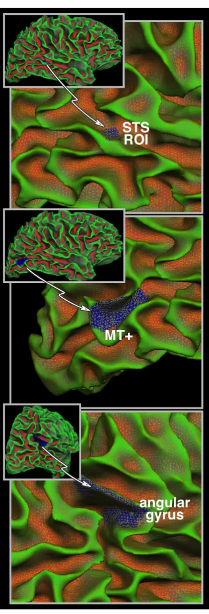 Figure 1. Depiction of selected ROIs on the convoluted corticalsurface. Due to the convoluted nature of the cortical sheet even small,functionally and histologically homogeneous regions will have variedspatial orientation