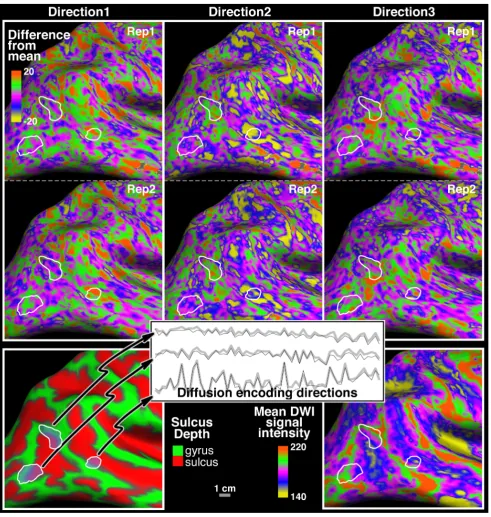 Figure 2. Test/re–test DWI signal intensity. The top two rows display the raw diffusion weighted image (DWI) signal intensity after the meanThe scale for all images is 1 cm.signal of all the 61 DWIs (see bottom right) has been subtracted from each