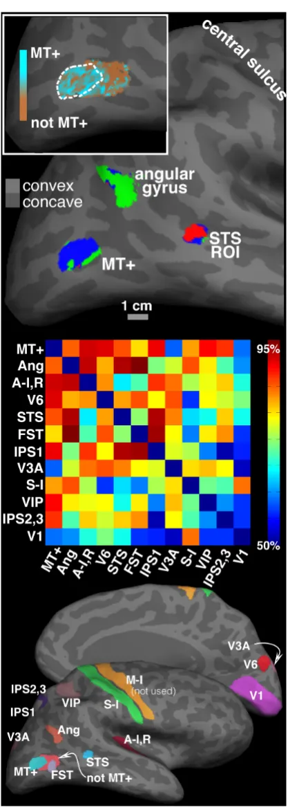 Figure 3. Classification results of the test/re–test data. (Top)same ROIs of the 2Classification results displayed on the map of cortical curvature