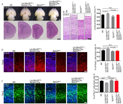 Fig. 4. Abnormally increased brain size and ratio of apical to intermediate NPCs in Lin28ameasurements averaged from at least three sections of each mutant embryo (-overexpressing mice are rescued by Rpl24Bst/+heterozygosity