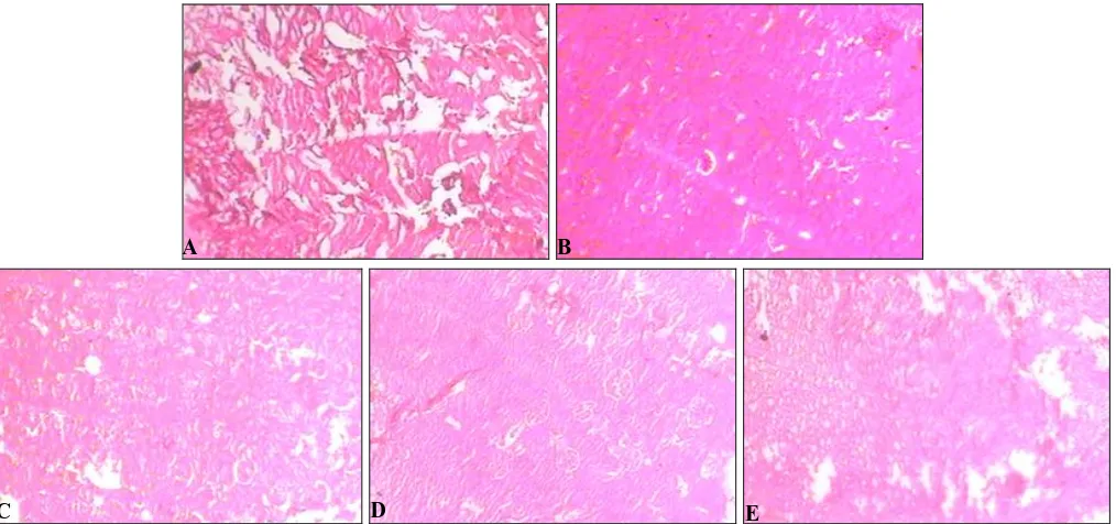 FIG. 4: MICROSCOPIC ARCHITECTURE AND CALCIUM OXALATE DEPOSITS IN THE KIDNEY SECTION. D 