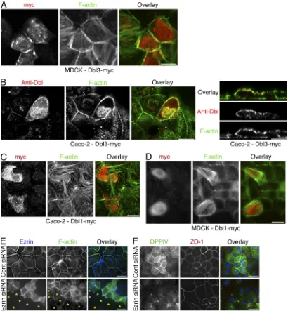 Figure S3.  Expression of Dbl isoforms and ezrin analysis. (A–D) Myc-tagged Dbl isoforms were transiently expressed in MDCK and Caco-2 cells and local-ized by immunofluorescence using antibodies against the myc tag (A, C, and D) or Dbl (B)