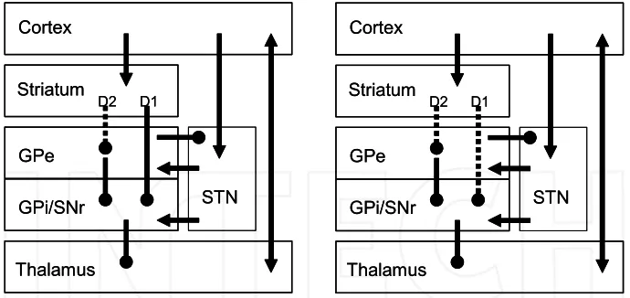 Fig. 1. Architecture of the basal ganglia. Not all connections are presented. Left: simplified situation in pHD with the degraded D2-pathway