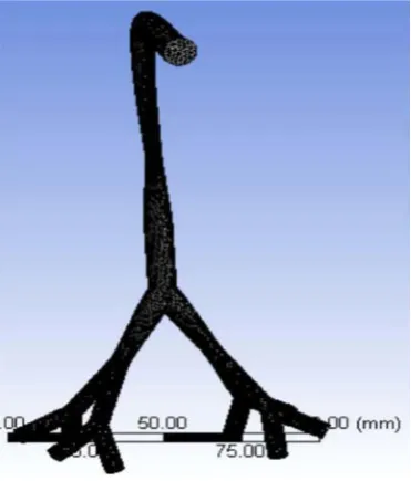 Figure 5. URT model with its boundary conditions. 