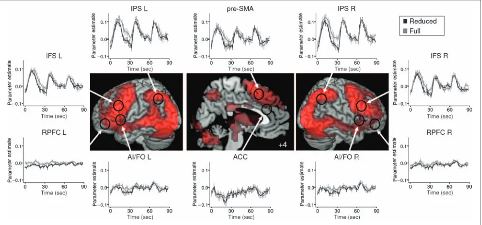 Figure 5. fMRI results from the analysis of BOLD activity during task instructions (B rules only)