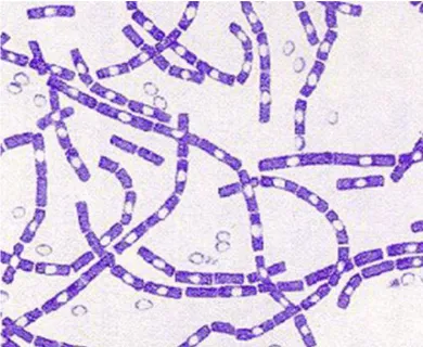 Figure 4. Gram stain 500 times more than Bacillus anthracis 