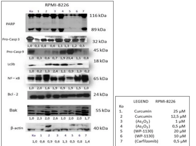 FIG. 3: WESTERN BLOT ANALYSIS WITH U-266 CELL LINE 48H AFTER TREATMENT WITH ARSENIC, WP-1130, CURCUMIN AND CARFILZOMIB  