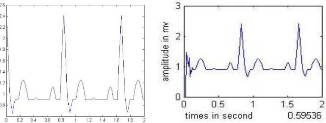 Figure 5 (a) ECG Signal (b) NLMS Algorithm 