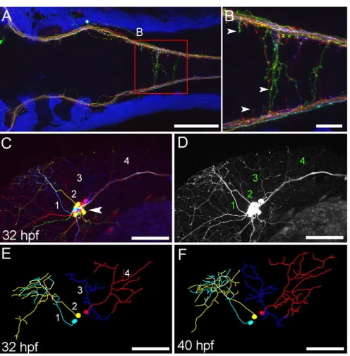 Fig. 4. Axon labeling and tracing. The transgenic line labels somatosensory neurons and their axons