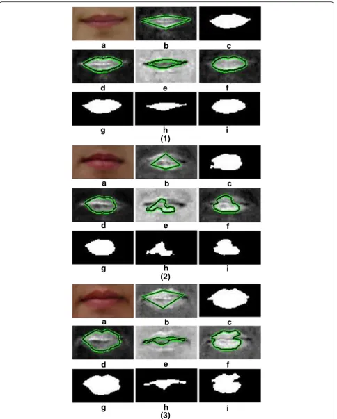 Fig. 8 1component.Segmentation result of C2 component.–3 a RGB image after illumination equalization