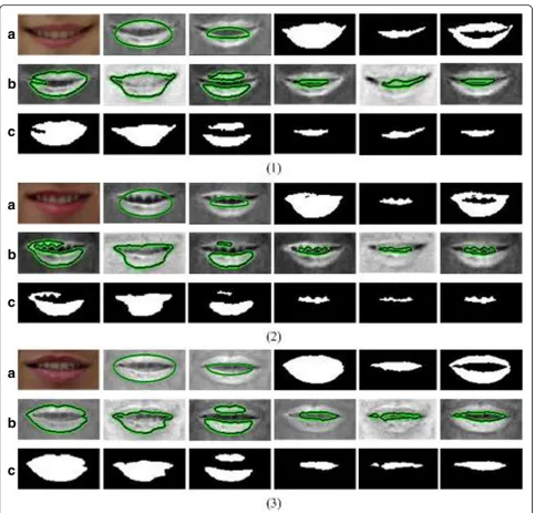 Fig. 9 1–3 a From left to right: RGB images after illumination equalization, outer initial contours, inner initial contours, results of outer boundary,results of inner boundary, final segmentation results; b Convergence results of outer and inner initial contour in U, C2 and C3 components; cSegmentation results of images in b