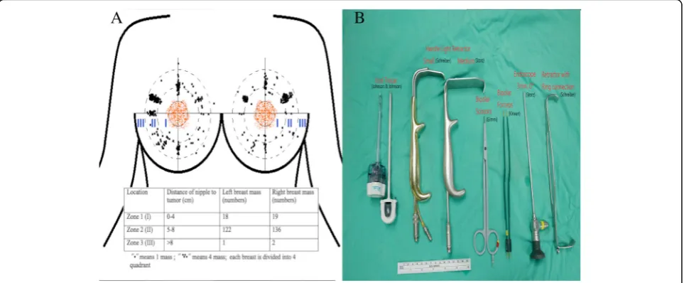Fig. 2 Illustration of surgical procedures:solution injection.the subcutaneous layer with tumescent solution.fascia dissection (with handle light retractor).(under endoscopic guidance)