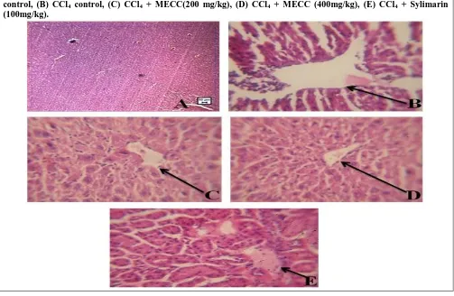 Table 2. Effect of Methanol extract of C. callosus (MECC) on liver biochemical parameters of CCl4 intoxicated Rats