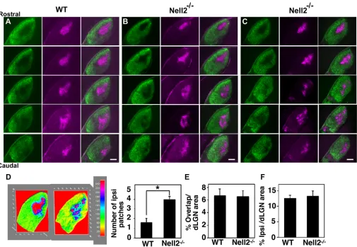 Fig. 2. Defects in the eye-specific retinogeniculate projection in Nell2−/− mice. (A-C) RGC axons of the right and left eyes were labelled at P9 by injectionwith cholera toxin B (CTB)-Alexa Fluor 488 (green) and CTB-Alexa Fluor 594 (magenta), respectively