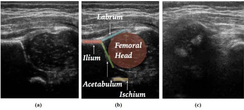 Figure 1: 2D slice examples of a) an adequate US slice, b) the slice in (a) with the relevant anatomy needed for adequacy annotated, and c) an inadequate US slice