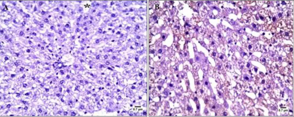 FIG. 4:  PHOTOMICROGRAPHS OF A SECTIONS OF THE LIVER OF (a, b) GROUP I SHOWING CLASSICAL HEPATIC LOBULE CONTAINING CENTRAL VEIN (*) SURROUNDED BY RADIATING HEPATIC CORDS (THIN ARROW) FORMED FROM HEPATOCYTES WITH VACUOLAR CYTOPLASM AND LARGE, ROUNDED CENTRAL 