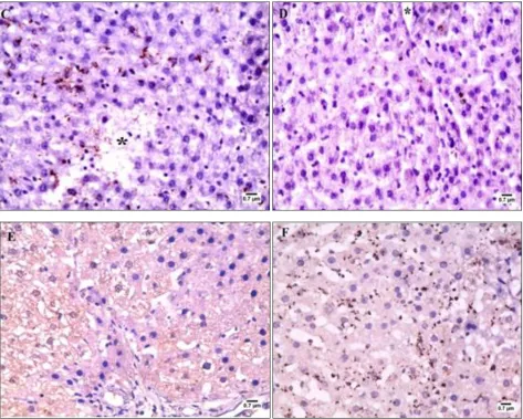 FIG. 5:  PHOTOMICROGRAPHS OF IMMUNOHISTOCHEMICAL STAINING OF CASPASE-3 IN THE LIVER SHOWING; A- CONTROL GROUP I NEGATIVE FOR CASPASE-3 IMMUNOREACTION
