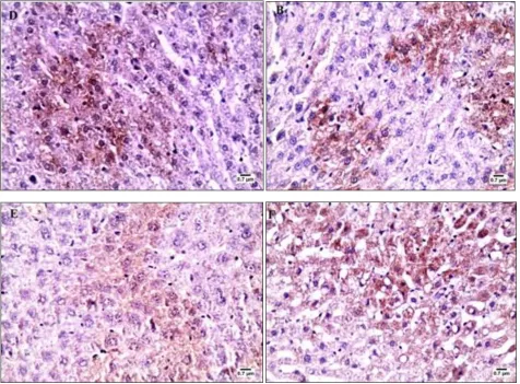 FIG. 6:  PHOTOMICROGRAPHS OF IMMUNOHISTOCHEMICAL STAINING OF (HSP) 70 IN THE LIVER A- LIVER OF CONTROL GROUP I SHOWING VERY FEW POSITIVE HSP70 IMMUNOSTAINED HEPATOCYTES
