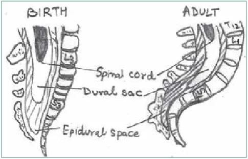 Figure 1. Differences in spinal anatomy between adults and children