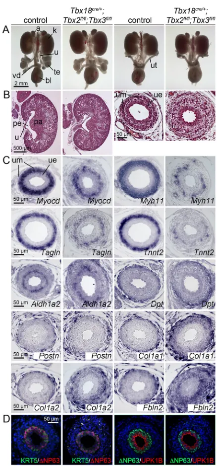 Fig. 2. Ureter anomalies in Tbx18urothelial differentiation by immunofluorescence of KRT5,nuclei (blue) are counterstained with DAPI