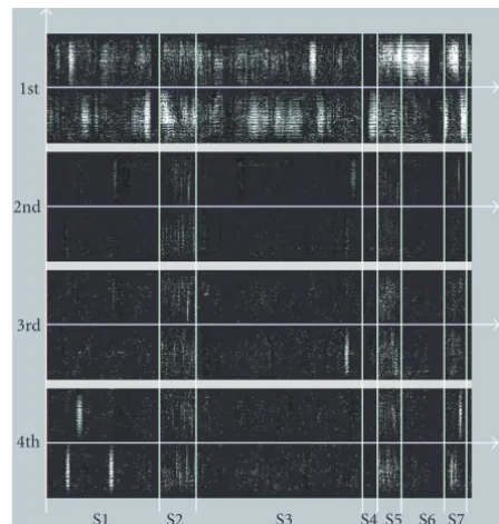 Figure 3: Directional slicing.