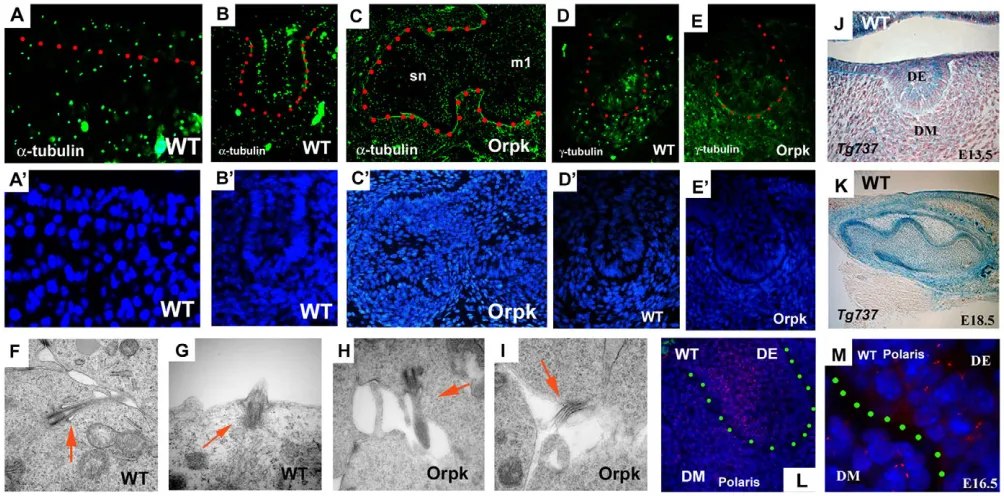 Fig. 2. Cilia, and Tg737 expression and localisation in tooth germs.-Tubulin-positive cells are observed in both tooth epitheliumalso show that polaris protein is localised in both dental epithelium (DE) and dental mesenchyme (DM)