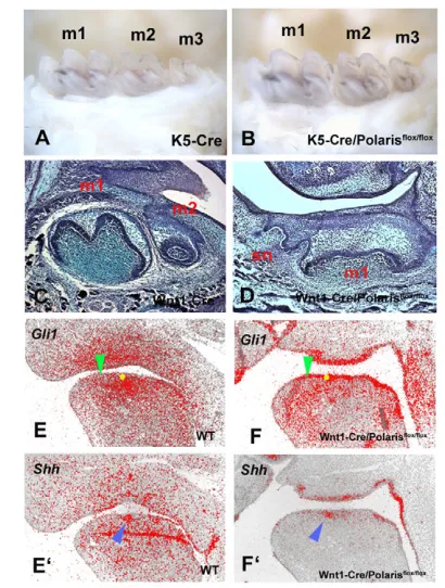 Fig. 3. Molar teeth of K5-Cre/polarisflox/floxK5Cre (A) and K5-Cre/polaris mice and Wnt1-Cre/polarisflox/flox mice