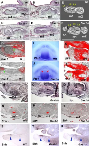 Fig. 4. Molar tooth phenotypes of Gas1 mutant mice.(A-F) Sagittal sections (A-D) and micro-CT analysis (E,F)