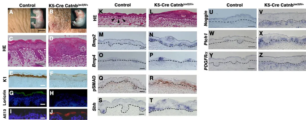Fig. 1. Switching of embryonic epidermal keratinocytes to HF fate in K5-Cre Catnb(ex3)fl/+E18.5