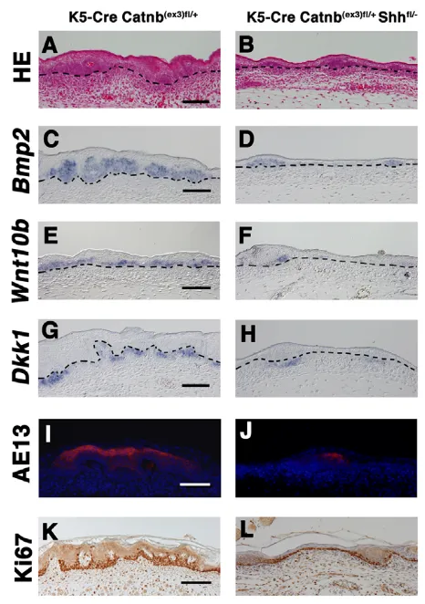 Fig. 3. The involvement of Shh signaling as a crucial downstreameffector of mutant K5-Cre Catnbproliferation analysis using Ki67 antibody at E18.5