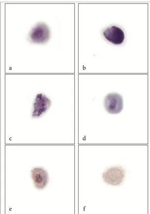 Figure 3: Cells in different apoptosis stages in treated cells are easily distinguishable