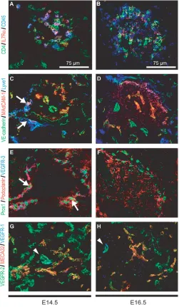 Fig. 1. Characterization of lymphatic endothelial cells in wild-type developing axillary lymph nodes.identified by combined staining for CD4 (green), which is expressed byLTi cells, IL7Rand CD45 (blue), which is expressed by all hematopoietic cells.(endoth