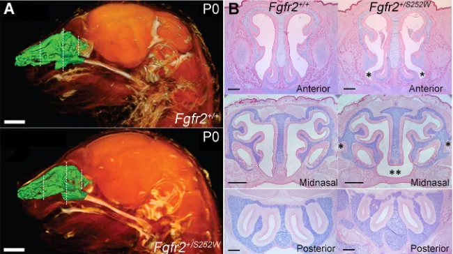 Fig. 1. Nasal airspace and three regions ofinvestigation in representativeS252Wsoft tissues (orange) and an endocast of thesegmented nasal passages (green)