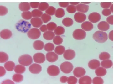Figure 3. Flow cytometry analysis of reticulocyte histogram. A. The population of gated red blood cells in scatter plot vis-à-vis the lateral distribution