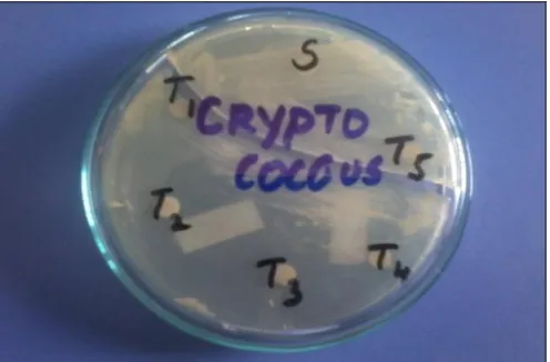 FIG.14: ANTI-FUNGAL ACTIVITY OF SYNTHESIZED COMPOUNDS (CANDIDA ALBICANS)  