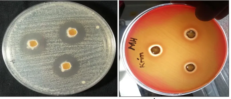 FIG.3: THE OPTIMUM CREAM’S ANTIBACTERIAL ACTIVITY ON S.EPIDERMIS BACTERIA (a) AND P. ACNES (a) green tea leaves extract cream or even the optimum cream did not cause irritation for skin use