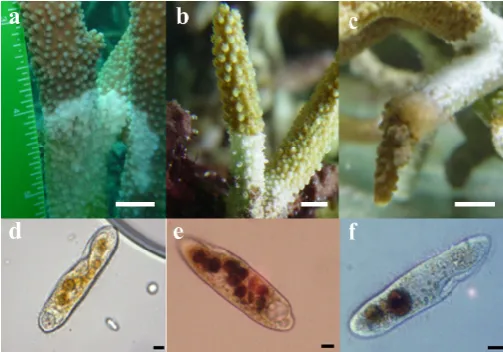 Figure 1. Sub set of samples exhibiting white syndrome (WS) and the dominant ciliates iting white syndrome in aquarium; (f) associated with the lesion interface; (a) wild Acropora muricata, from Heron Island on the Great Barrier Reef, (b) Acropora sp