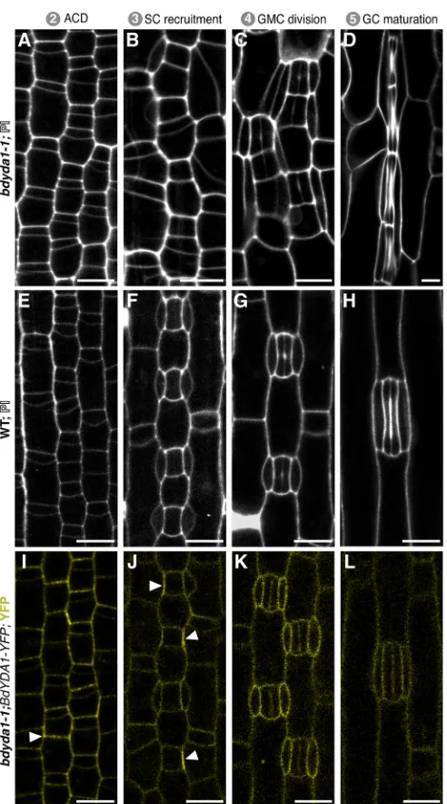 Fig. 3. Imaging early development indicates that BdYDA1 is expressedthroughout the stomatal lineage and that the initial defect in6 dpg; YFP channel only)
