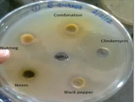 FIG. 6D: ZONE OF INHIBITION OF COMBINATION  OF NEEM, NUTMEG AND BLACK PEPPER AGAINST S