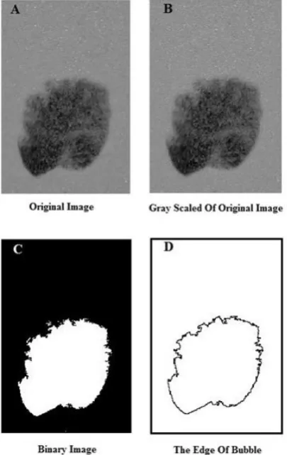 Figure 2.  A) main image, B) Grayscale image, C) binary image and D) the detected edge of the bubble
